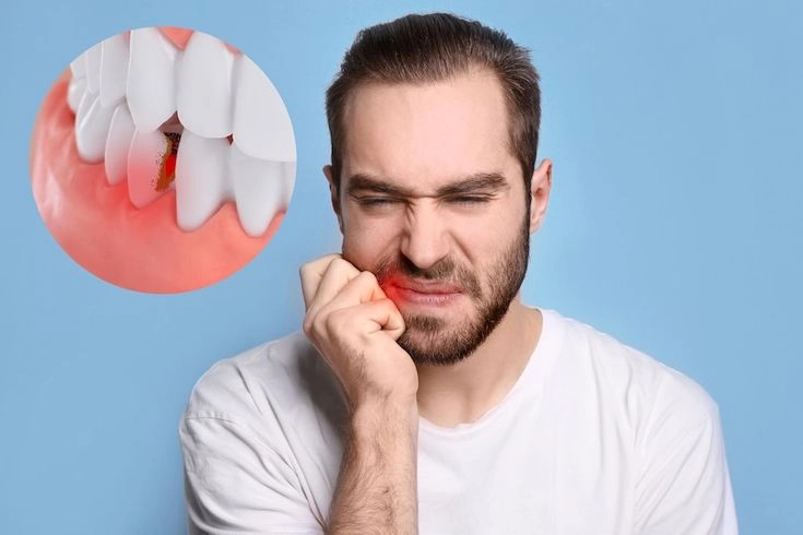 Man suffering from severe tooth pain and gum infection, highlighting the need for treatment at the best dental clinics in Kasaragod.